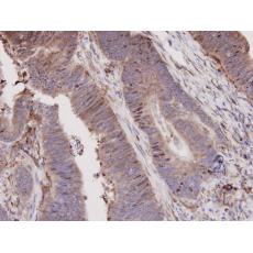Anti-N-Cadherin antibody