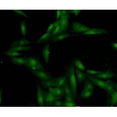 Anti-HMGB1 antibody