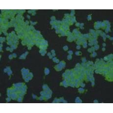 Anti-Alpha smooth muscle Actin antibody