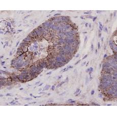 Anti-GPR49/LGR5 alpha/beta antibody