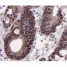 Anti-SIRT1 antibody