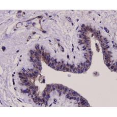 Anti-ERK1 antibody