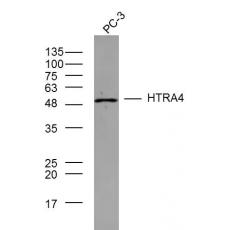 Anti-HTRA4 antibody