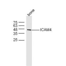 Anti-ICAM4 antibody