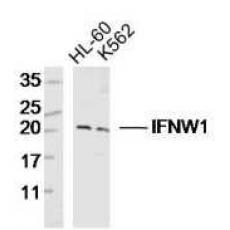 Anti-IFNW1 antibody