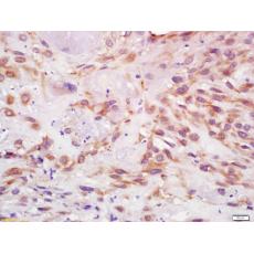 Anti-IGF I antibody