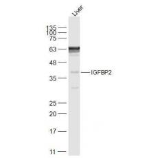 Anti-IGFBP2 antibody