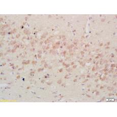 Anti-IGFBP3 antibody