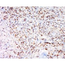 Anti-IGFBP5 antibody