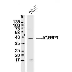 Anti-IGFBP9 antibody