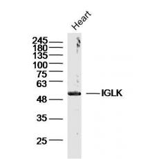 Anti-IGLK antibody