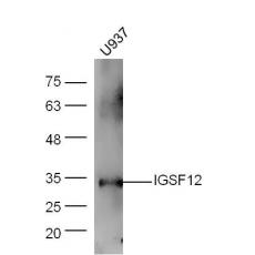 Anti-IGSF12 antibody
