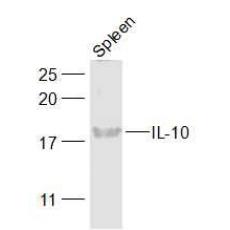 Anti-IL-10 antibody