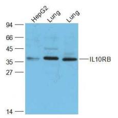 Anti-IL10RB antibody