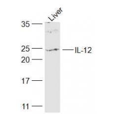 Anti-IL-12 antibody