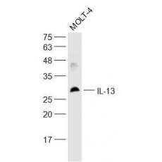 Anti-IL-13 antibody