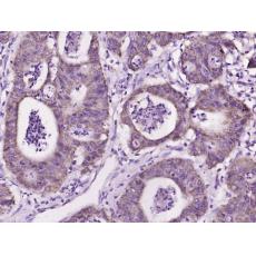 Anti-IL17C antibody