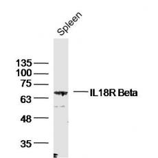 Anti-IL18R Beta antibody