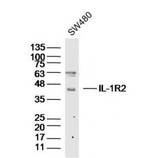 Anti-IL-1R2 antibody