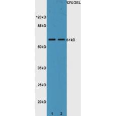 Anti-IL22R antibody