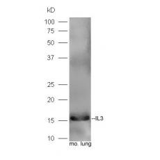 Anti-IL3 antibody