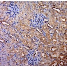 Anti-IL-5 antibody