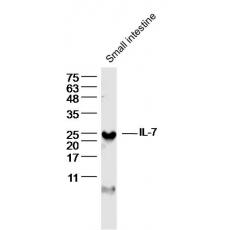 Anti-IL-7 antibody