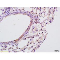 Anti-IL-9 antibody