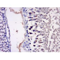 Anti-IMPACT antibody
