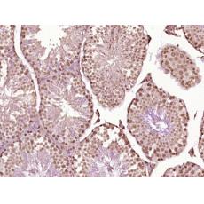 Anti-IMPDH1 antibody