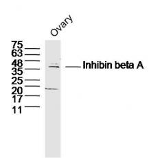 Anti-Inhibin beta A antibody
