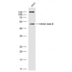 Anti-Inhibin beta B antibody