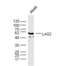 Anti-LAS2 antibody