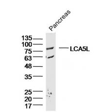 Anti-LCA5L antibody