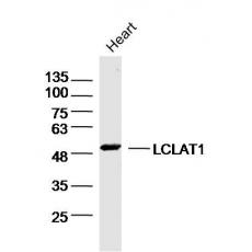 Anti-LCLAT1 antibody