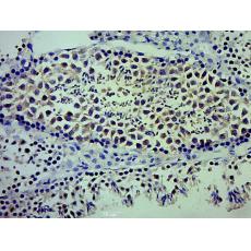 Anti-LCN8 antibody
