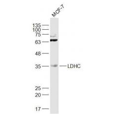 Anti-LDHC antibody