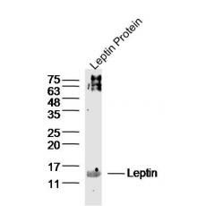 Anti-Leptin antibody