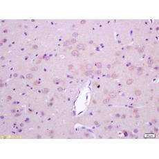 Anti-LGI1 antibody