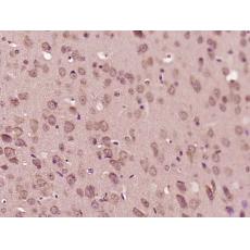 Anti-LGI2 antibody