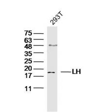 Anti-LH antibody