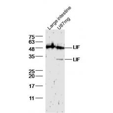 Anti-LIF antibody