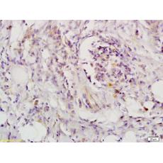 Anti-LIFR antibody