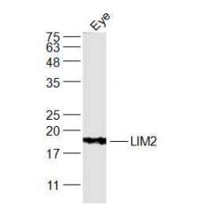 Anti-LIM2 antibody