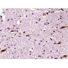 Anti-LIMK1 antibody