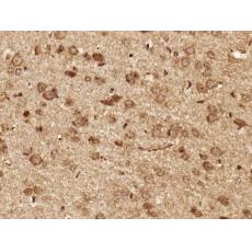 Anti-Liprin alpha 2 antibody