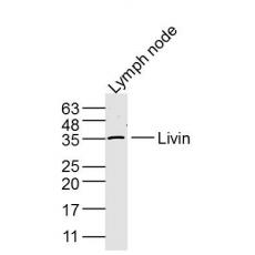 Anti-Livin antibody