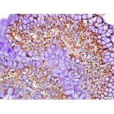 Anti-LKB1 antibody