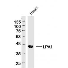 Anti-LPA1 antibody