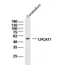 Anti-LPCAT1 antibody